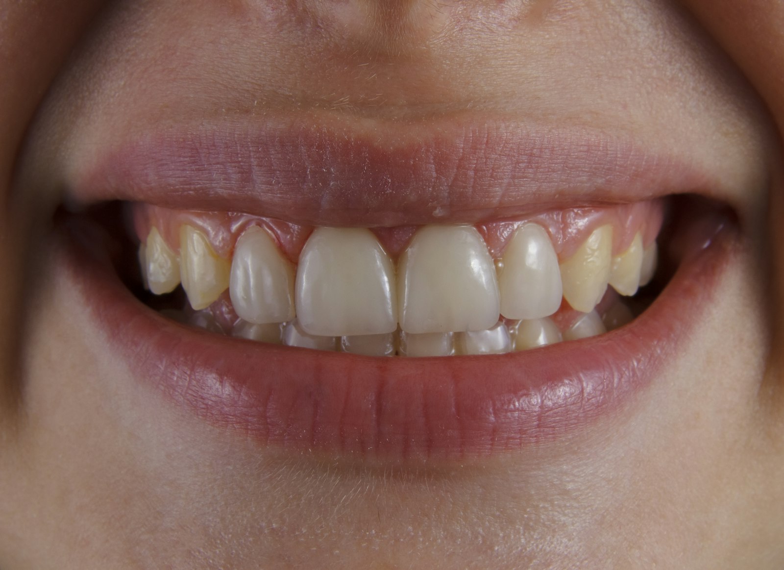 Sorriso saudável
