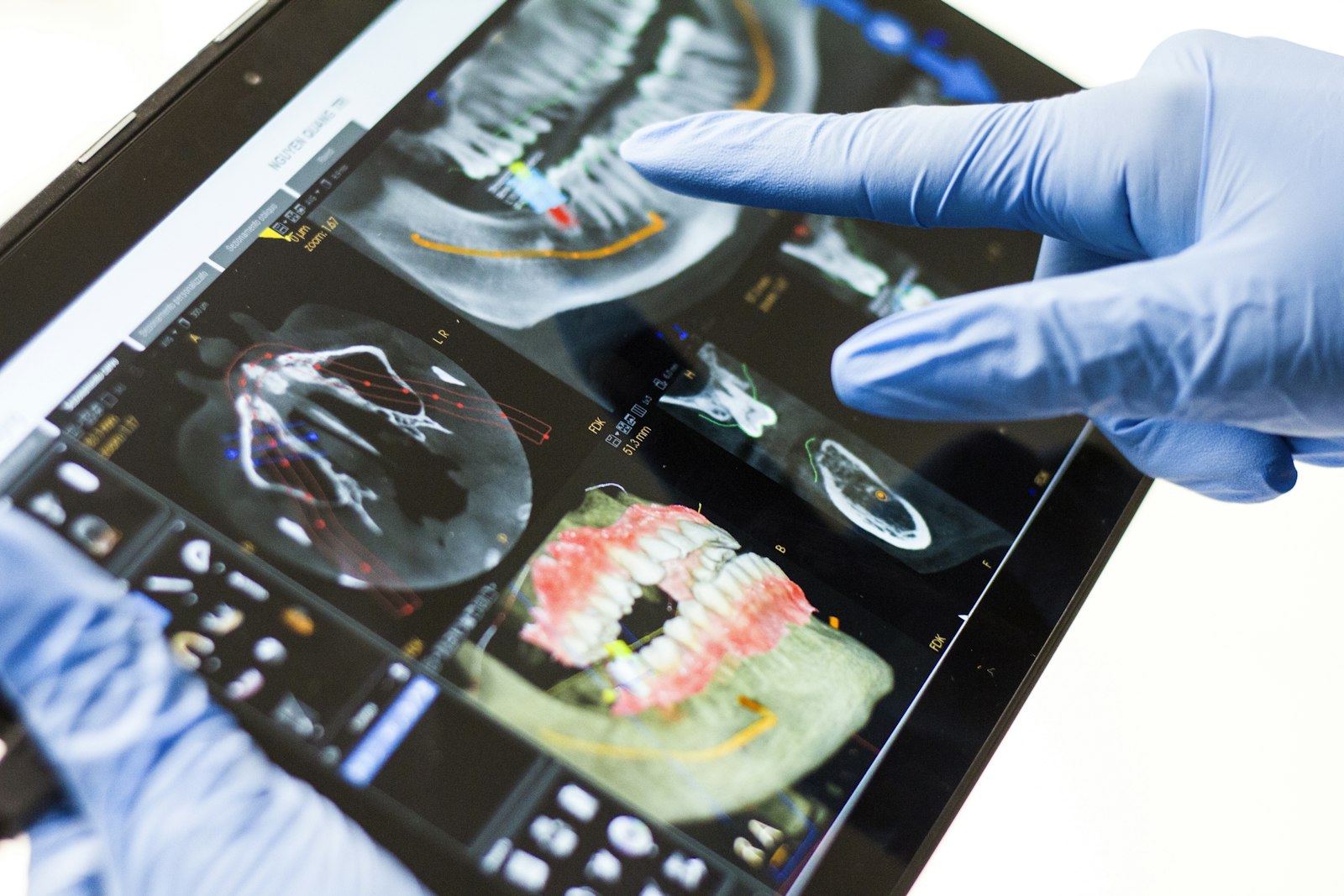 Diagnóstico dentário digital num tablet